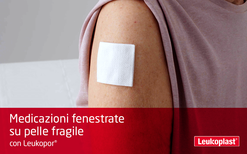 Qui possiamo vedere in primo piano come le medicazioni fenestrate sono applicate sulla pelle fragile con l'aiuto di un cerotto traspirante su rocchetto: un operatore sanitario sta fissa un tampone sulla spalla di una signora con il cerotto su rocchetto Leukopor. Qui possiamo vedere in primo piano come le medicazioni fenestrate sono applicate sulla pelle fragile con l'aiuto di un cerotto traspirante su rocchetto: un operatore sanitario sta fissa un tampone sulla spalla di una signora con il cerotto su rocchetto Leukopor.